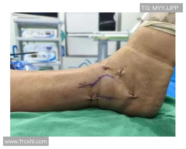 足球运动员关节磨损的有效预防与治疗方法分析